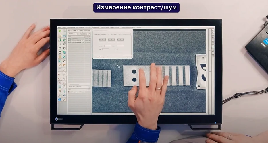 Программное обеспечение для цифровой радиографии